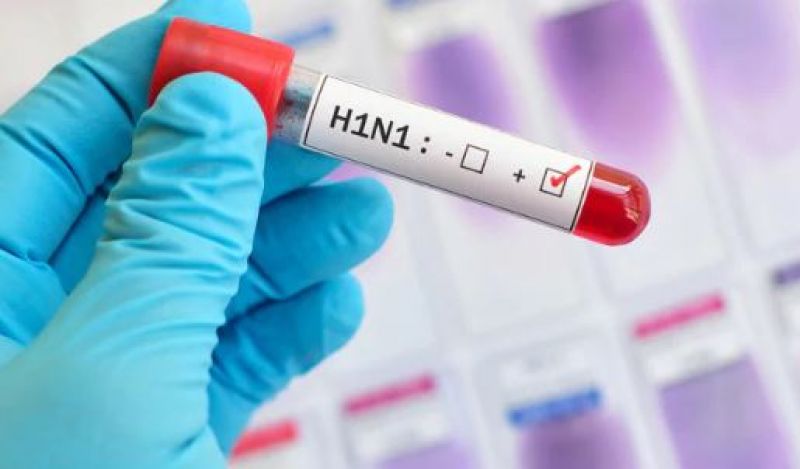 H1N1 test for swine flu