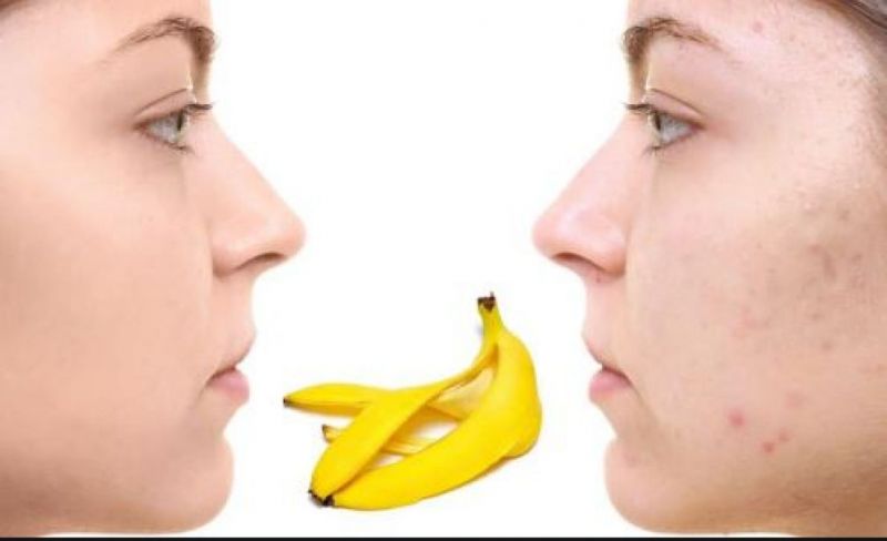 Banana Banana