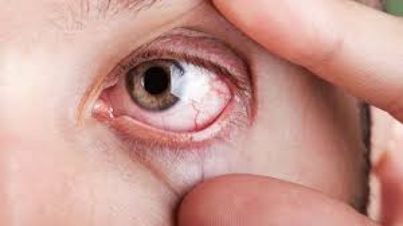 Treat cure diseases with use of Saffron