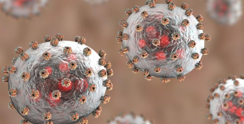 Lassa fever Lassa fever