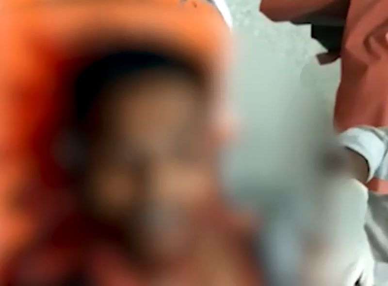 Attempts to present his own head