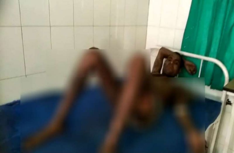 Dalit youth set on fire