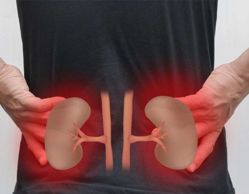 Kidney Problem