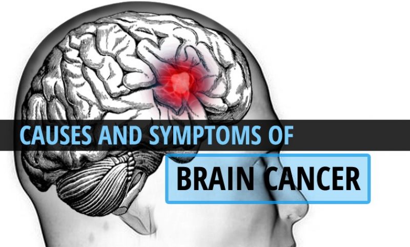 Brain Cancer