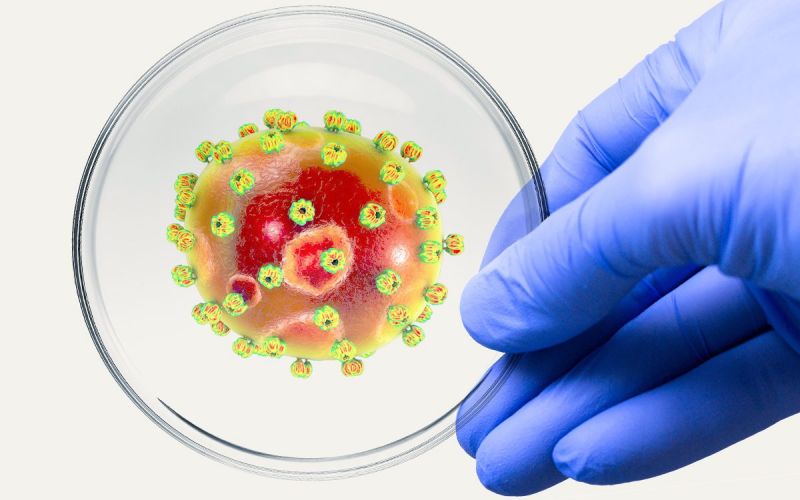 Lassa fever Lassa fever