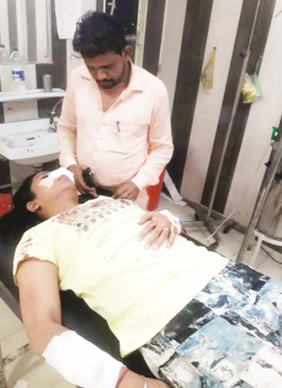 Doctor bites on wife's nose over domestic dispute