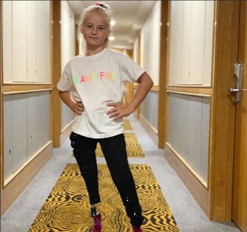Girl lost both legs rare disease walk new york fashion week Girl lost both legs rare disease walk new york fashion week