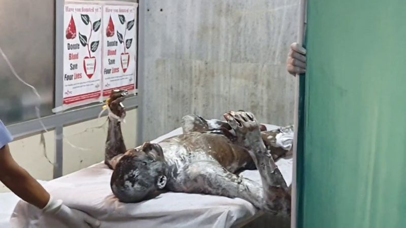 Tragic accident in Khanna, hot iron falls on workers