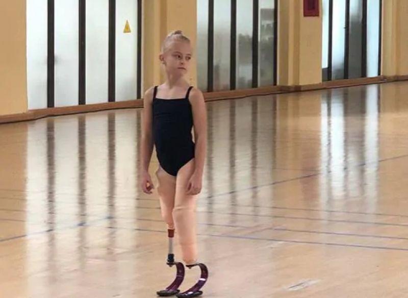 Girl lost both legs rare disease walk new york fashion week Girl lost both legs rare disease walk new york fashion week