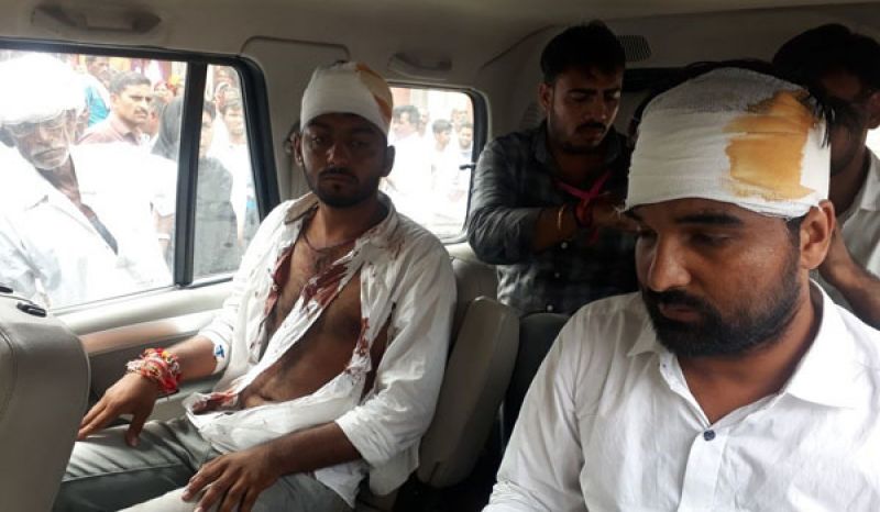 Unidentified men attack Rajasthan NSUI chief ahead of university elections