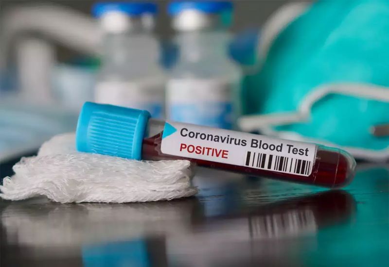 Corona Virus Corona Virus