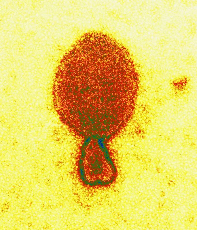 Zoonotic Langya Virus Found in China Zoonotic Langya Virus Found in China