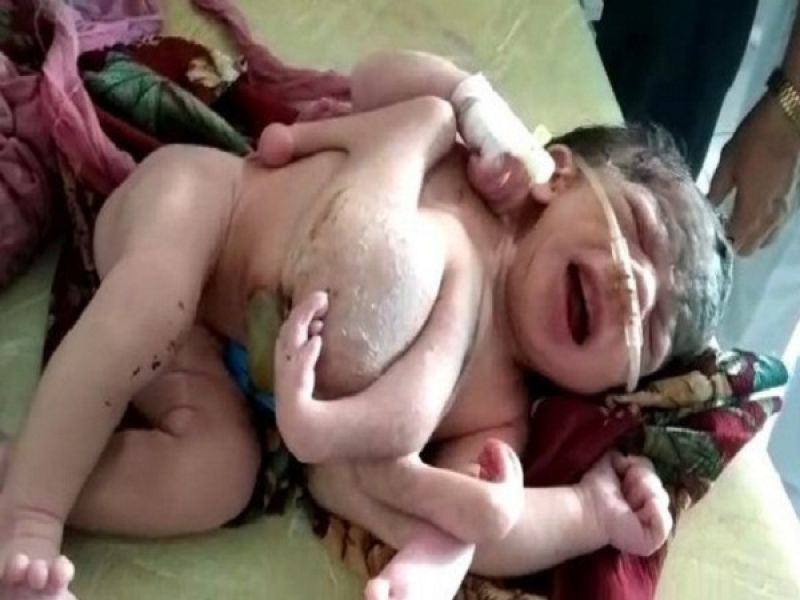 Four legged girl born in Rajasthan