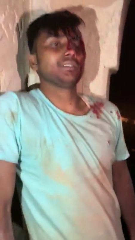 Lightning strikes people enjoying pleasant weather