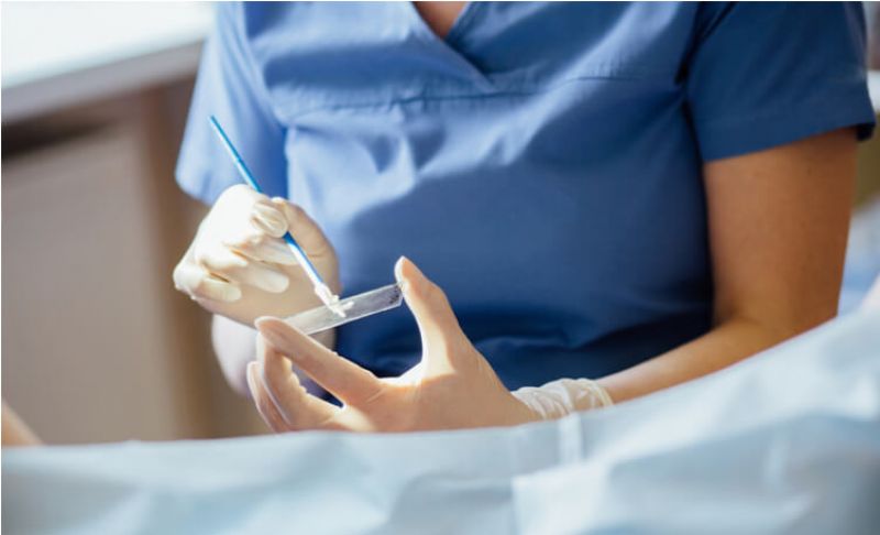 Pap Smear Test Pap Smear Test