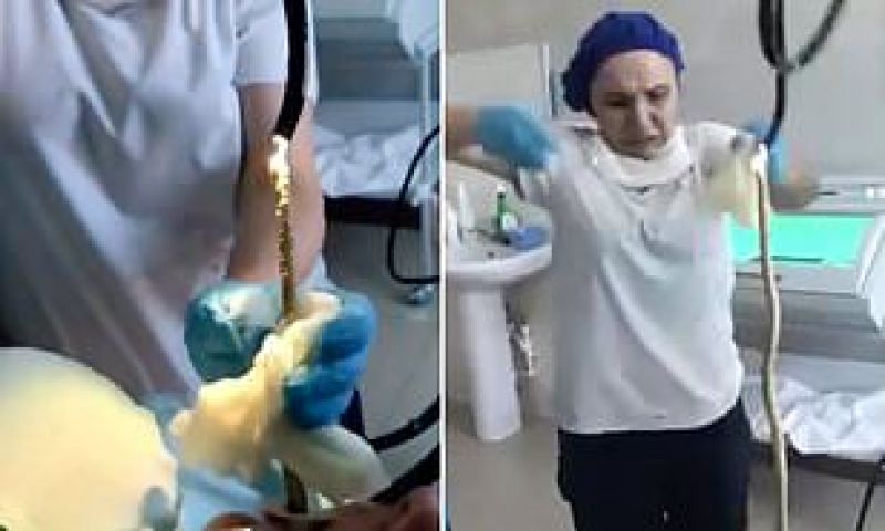 Doctors Pull 4-Feet Snake Out of Woman’s Mouth in Russia