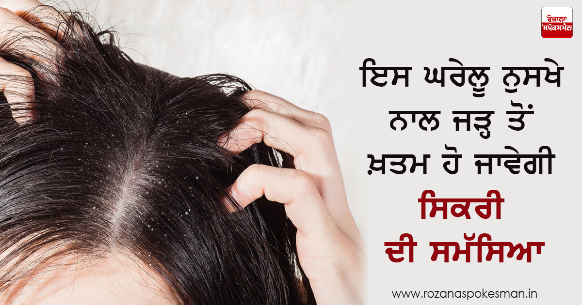 ਸਿਕਰੀ ਨੂੰ ਦੂਰ ਕਰਨ ਦਾ ਘਰੇਲੂ ਉਪਾਅ ਸਿਕਰੀ ਨੂੰ ਦੂਰ ਕਰਨ ਦਾ ਘਰੇਲੂ ਉਪਾਅ